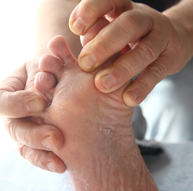 Diabetes Foot Infections What to Know HealthCentral