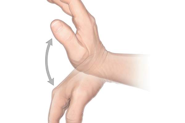 手腕弯曲
