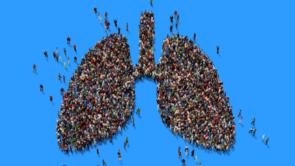 Non Small Cell Lung Cancer Market Nsclc Market Delveinsight
