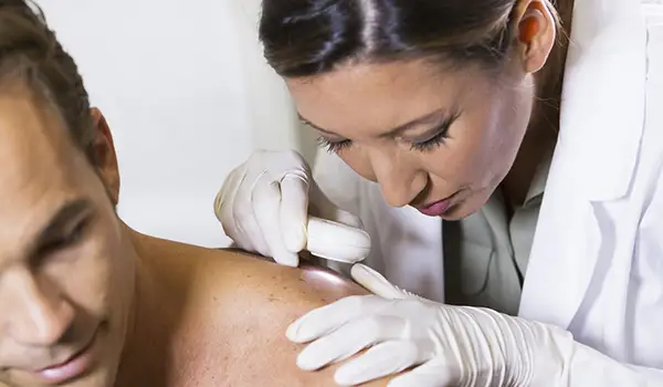 皮肤科医生检查在人的肩膀的皮肤为皮肤癌症。