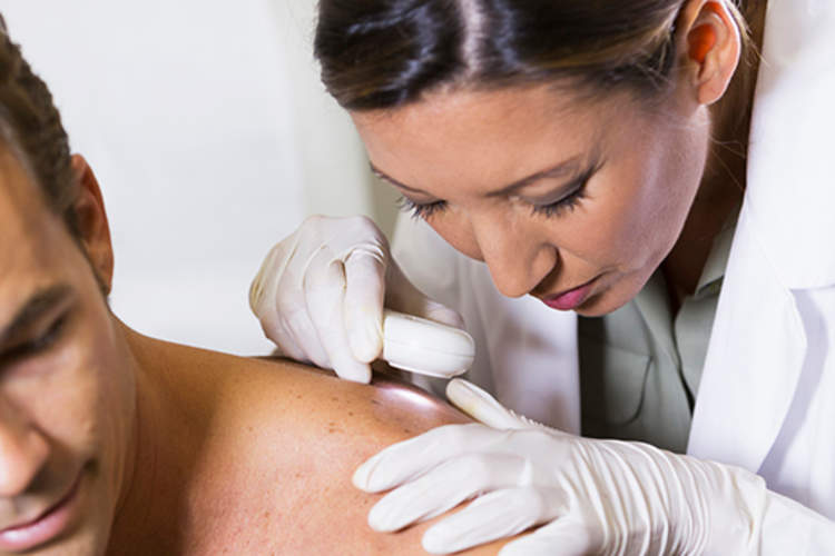 皮肤科医生检查皮肤对人的肩膀皮肤癌。