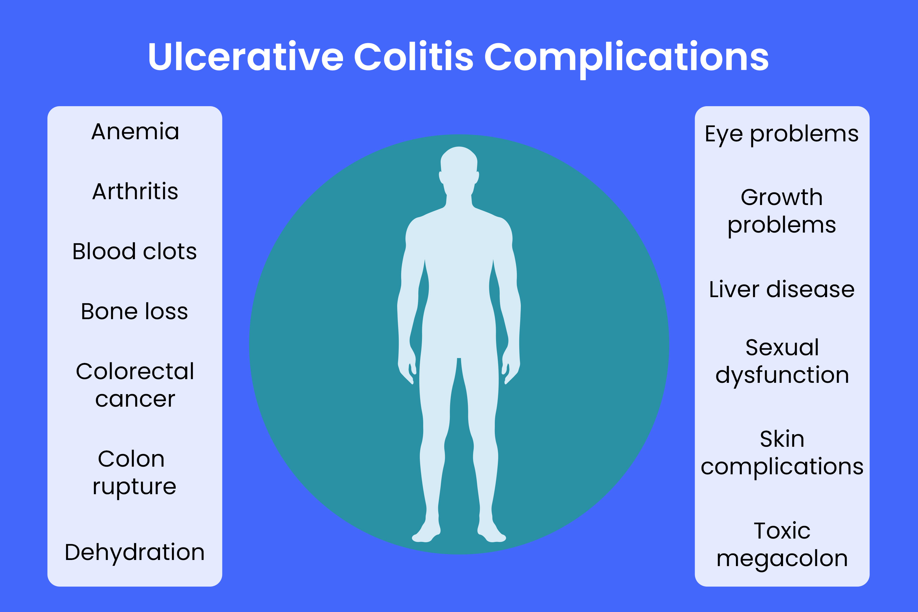 Ulcerative Colitis Complications: Bleeding, Colorectal Cancer and More