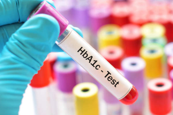 糖化血红蛋白验血viles
