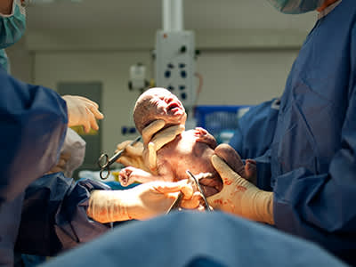 拿着医生通过剖腹产出生的新生婴儿。