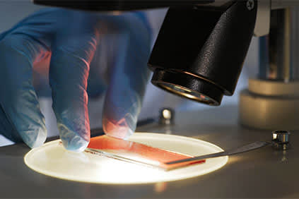 在显微镜下观察血细胞。