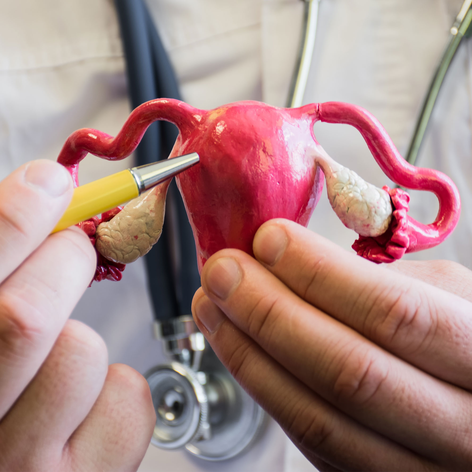 医生拿着模型的一个特写镜头的子宫