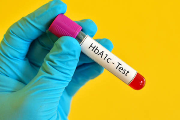 糖化血红蛋白的血液通过卑鄙蓝色手套的手举行。