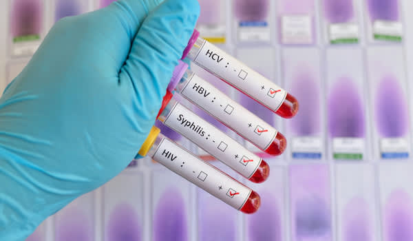 STDs and HIV Testing Frequently Asked Questions STDs and HIV Testing Frequently Asked Questions
