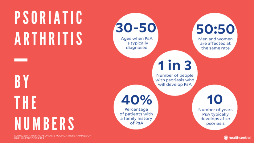 银屑病性关节炎的统计:确诊时的年龄，PsA对男性和女性的影响相同，将发展为PsA的银屑病患者人数，有PsA家族史的患者比例，银屑病后发展为PsA的年数