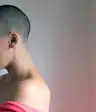 有病的光头少女