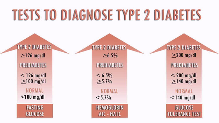 诊断2型糖尿病的测试。