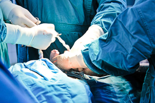 医生进行剖腹产。