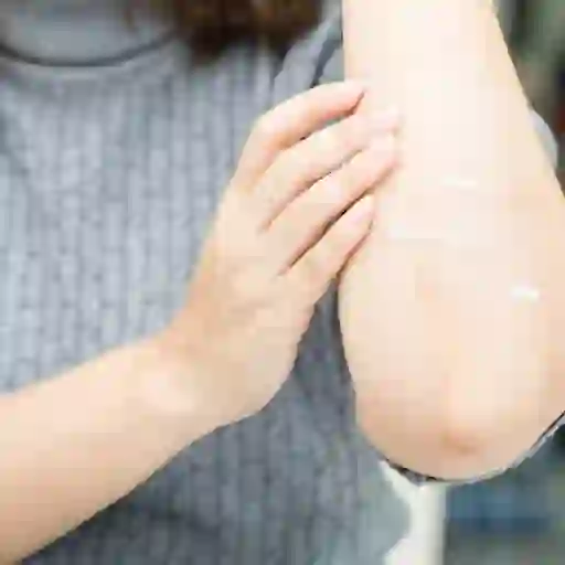 女人给手肘乳液