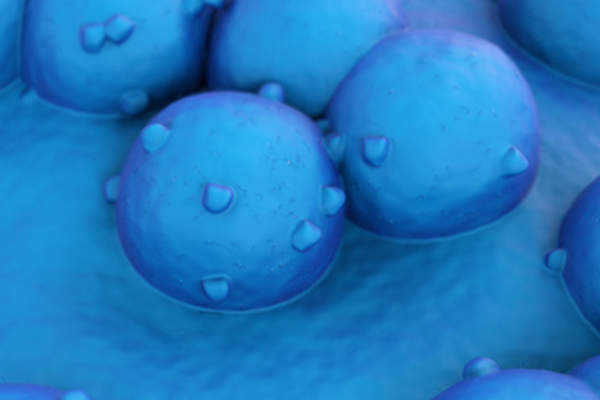 肺癌细胞扫描电镜图像。