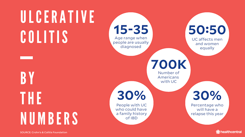 溃疡性结肠炎统计:诊断年龄,UC对男性和女性的影响相同,有UC的美国人的数量,有IBD家族史的患者的百分比,每年复发的患者的百分比