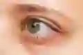 A closeup of a red eye