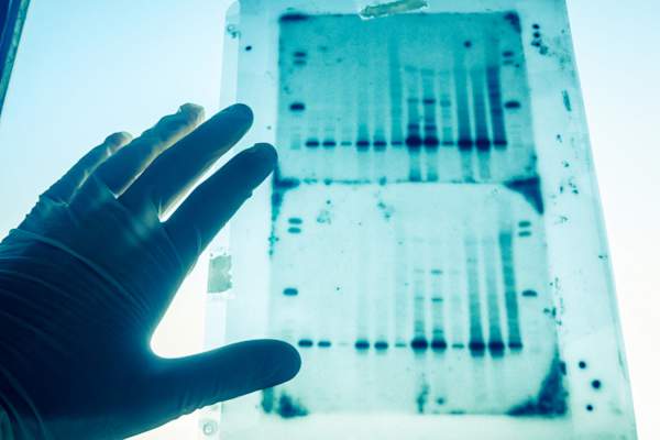 DNA遗传分析结果