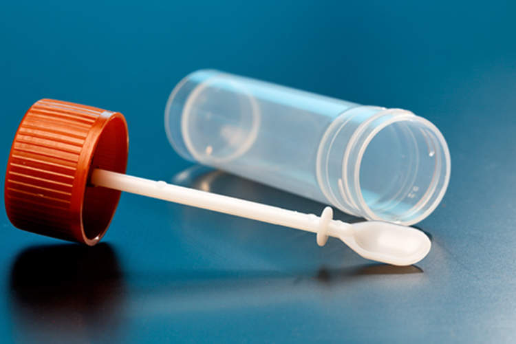 粪便试验样品收集器。