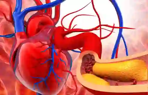 胆固醇和心脏模型。