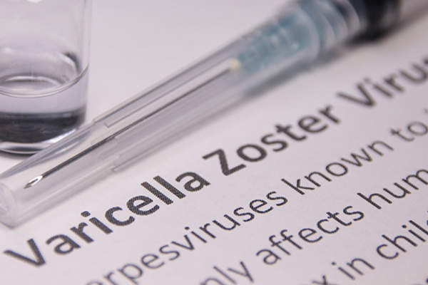 带状疱疹病毒。