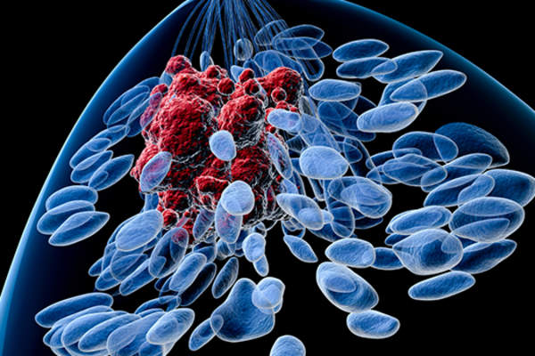 乳腺癌细胞图像。