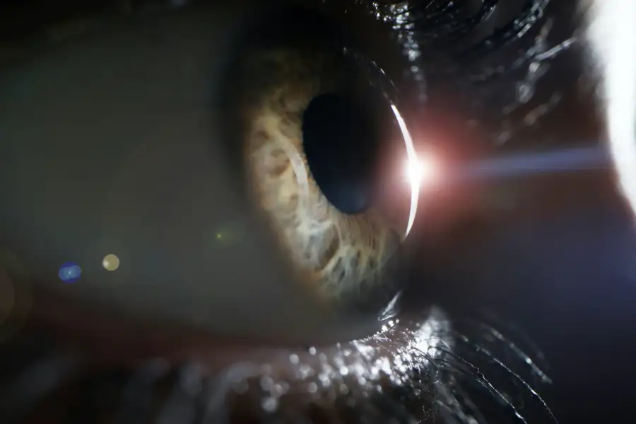 How Wet AMD Affects Your Vision