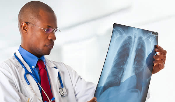肿瘤学家检查肺x射线