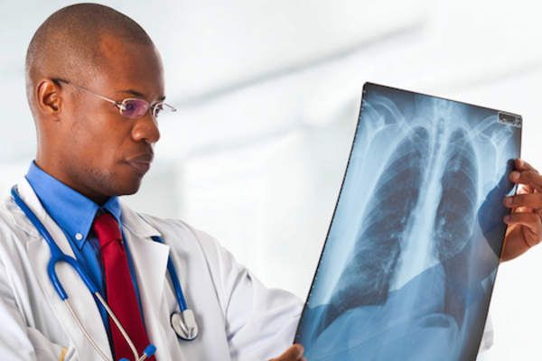 肿瘤学家检查肺x射线