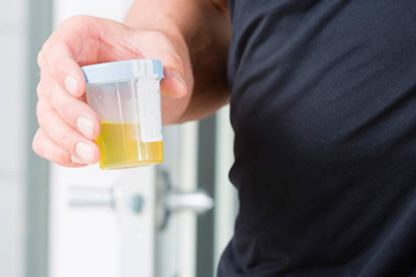 在收集容器尿样。