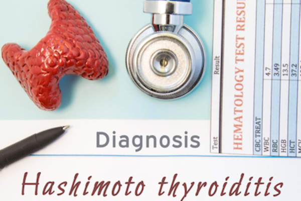 桥本甲状腺炎诊断概念。