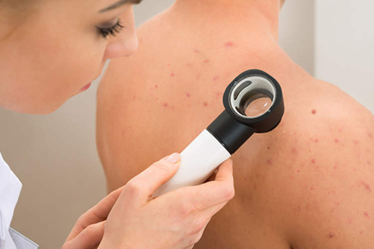 皮肤科医生检查对女人的肩膀皮肤。