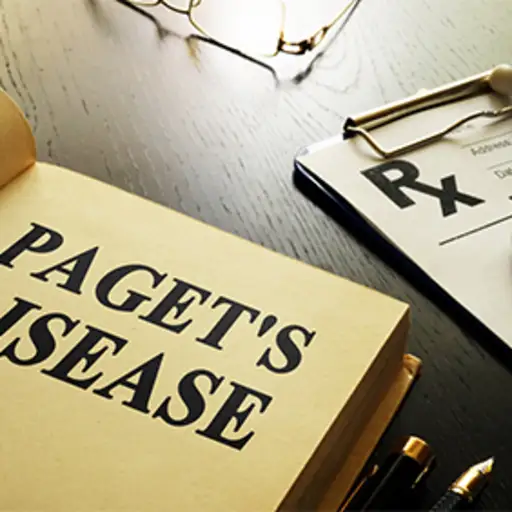 Bood about Paget's disease.