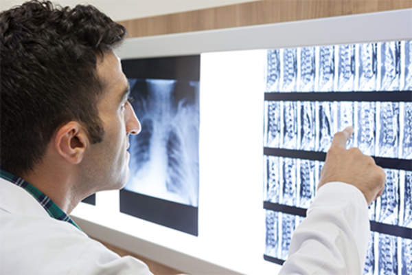 医生正在看脊柱的x光片。