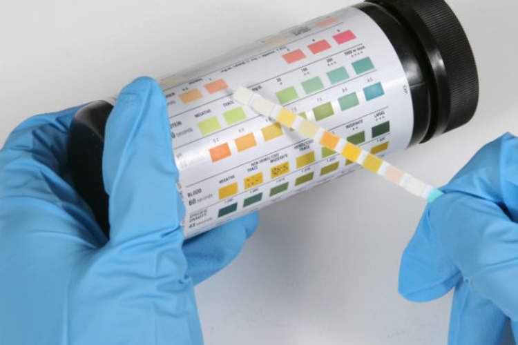样品试纸