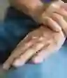 一个有牛皮癣的男人握住手腕