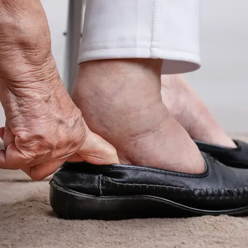 试着把肿胀的脚塞进鞋子里。