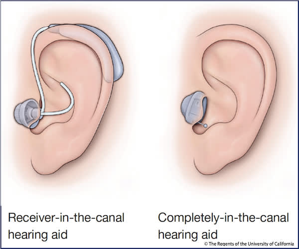 买到最好、最实惠的助听器的4个步骤——如何购买助听器