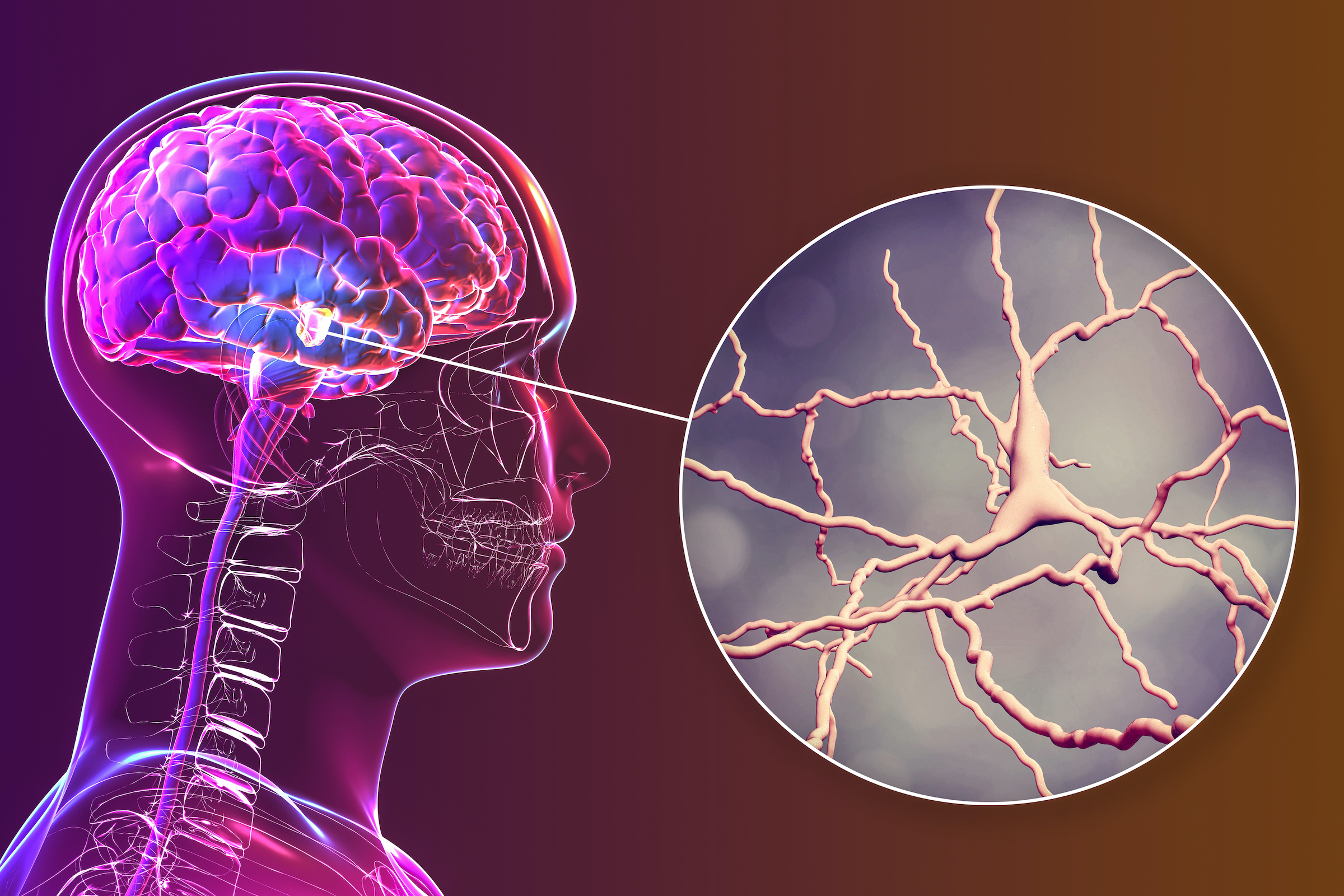 Память движений. Parkinson's disease (PD). Паркинсон.