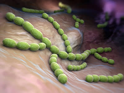 肺炎链球菌的细菌。