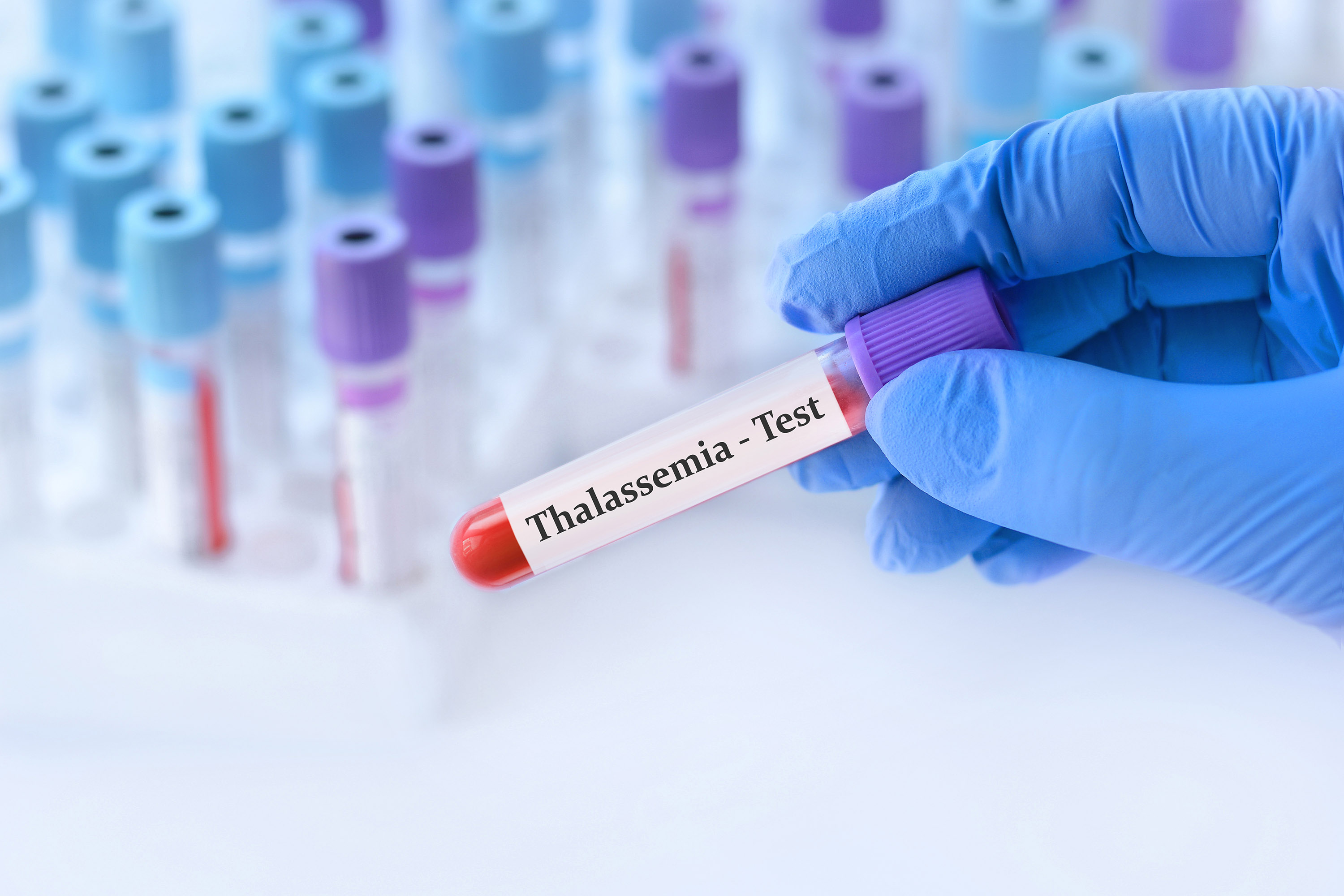 Your Guide to AQVESME™ (mitapivat) for Thalassemia