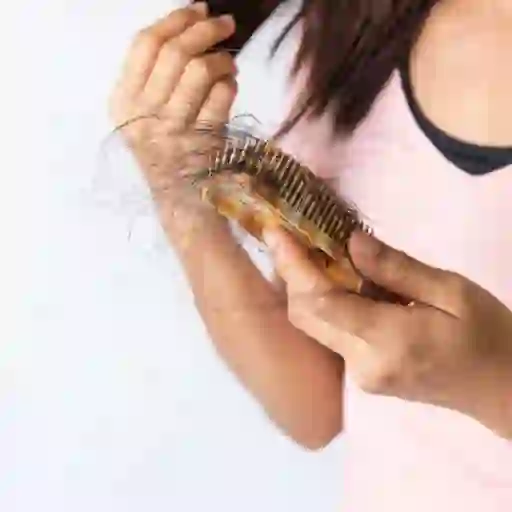 脱发