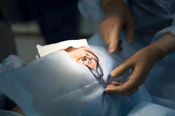 医生调整盖窥器