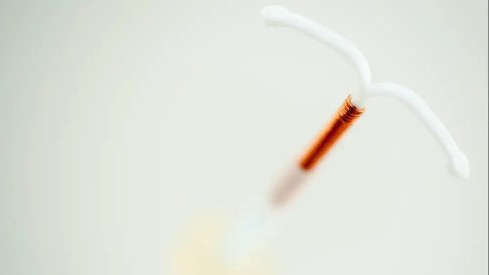 paragard iud side effects
