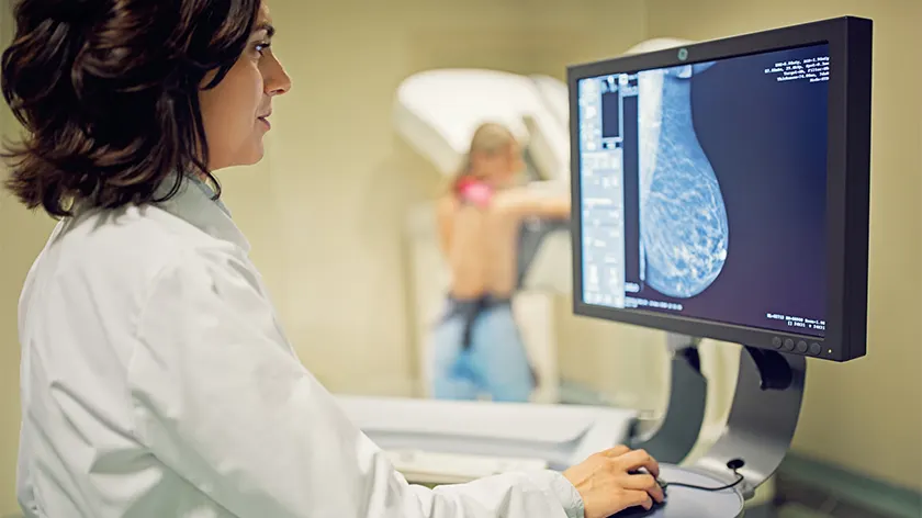 乳房x光检查。