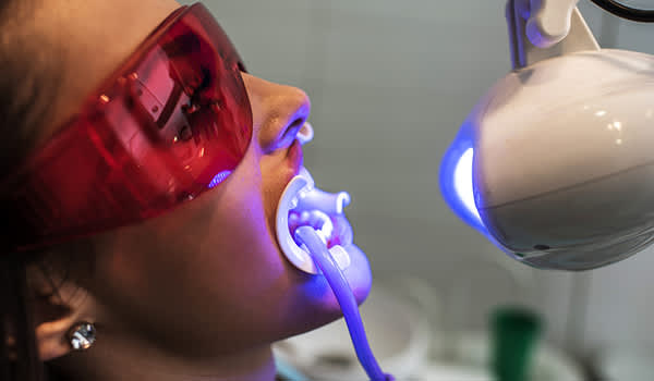 一名妇女在牙医诊所做牙齿美白手术。