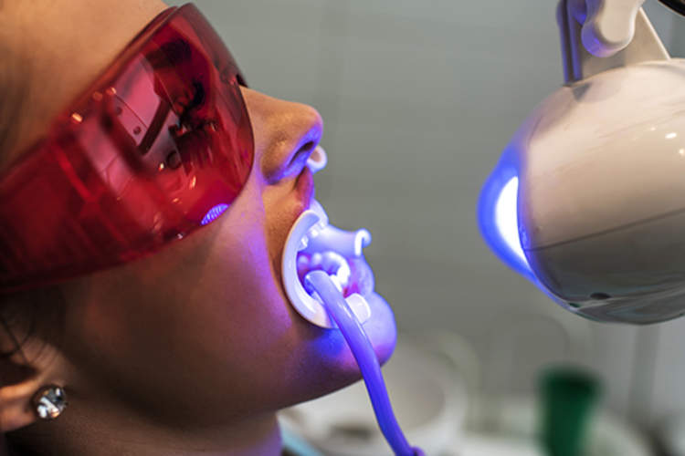 让女人在牙医诊所增白她的牙齿。