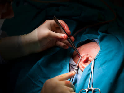 外科医生在下颚手术后给病人缝合。