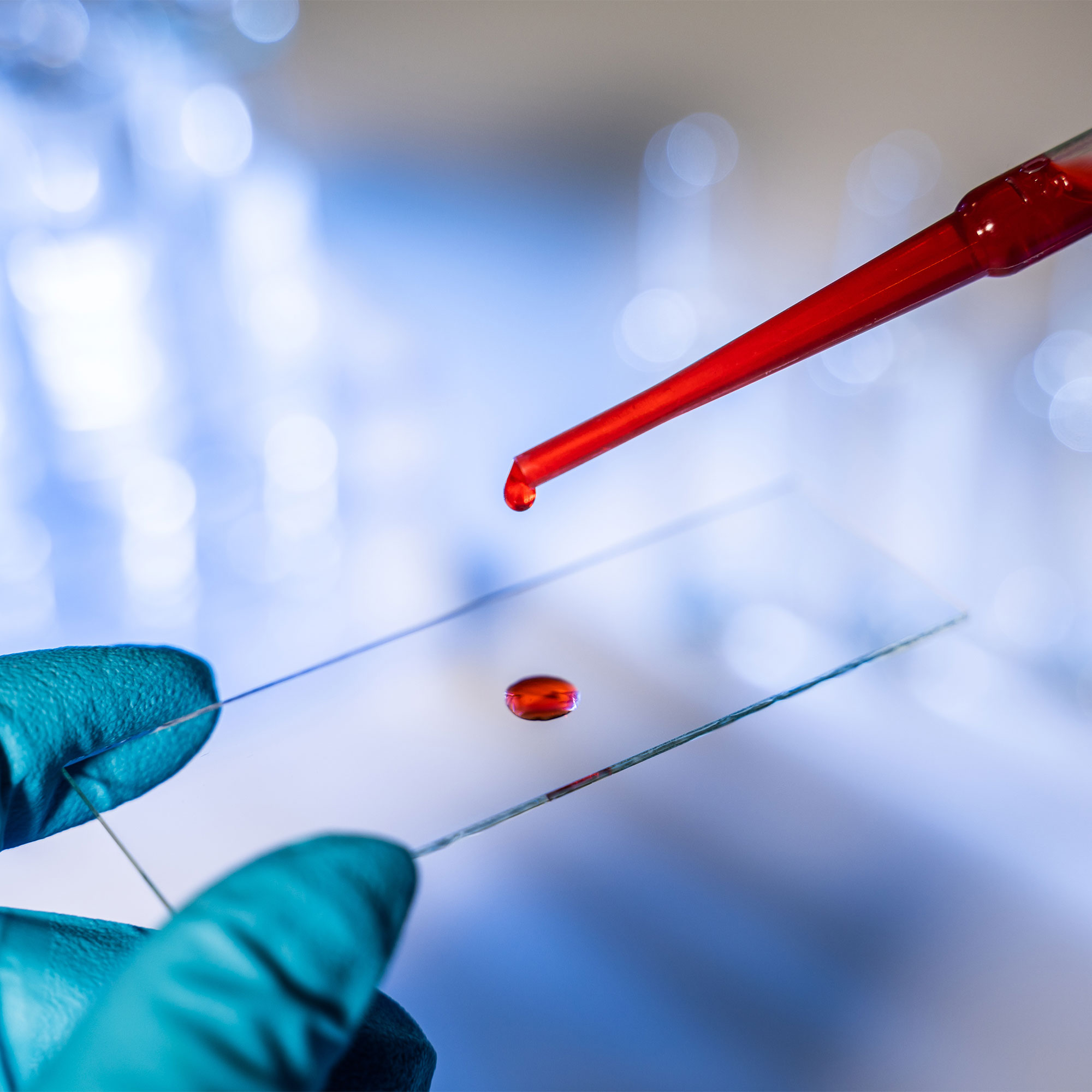 一个人用血液样本准备载玻片