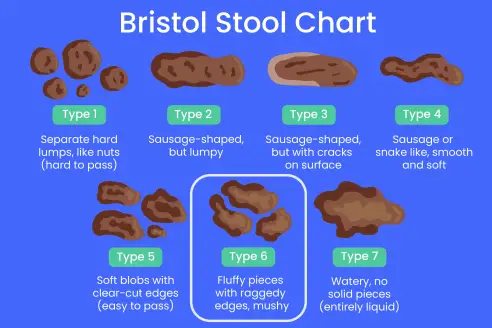 types of stool