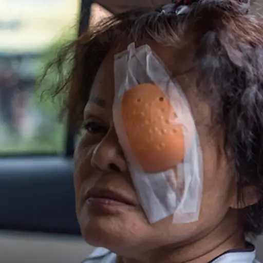 眼科手术后离开医院